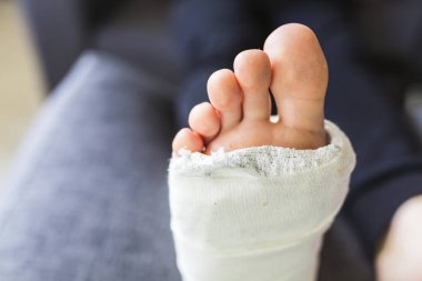 alçıda yastığın üzerinde dinlenme yuvarlak bacak