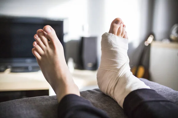 Geaard thuis met een been in het gips — Stockfoto