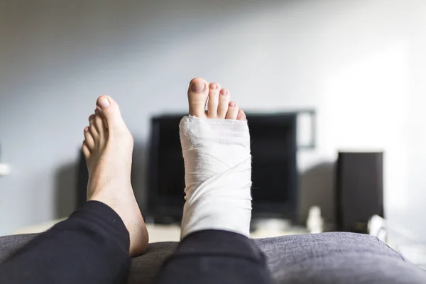 Descansando com uma perna quebrada em casa — Fotografia de Stock