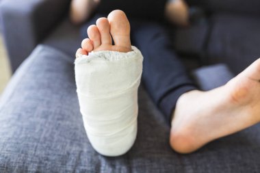Tedavi sırasında alçıda kırık bacak