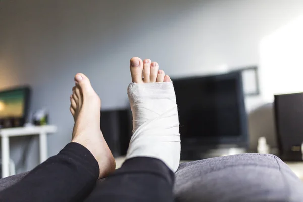 Odpočívá se zlomenou nohou doma — Stock fotografie