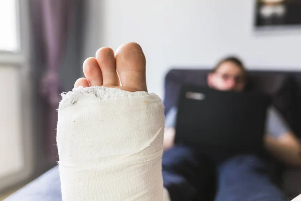 Close-up op een been in het gips — Stockfoto