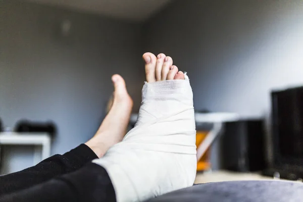 Mit gebrochenem Bein zu Hause liegen — Stockfoto
