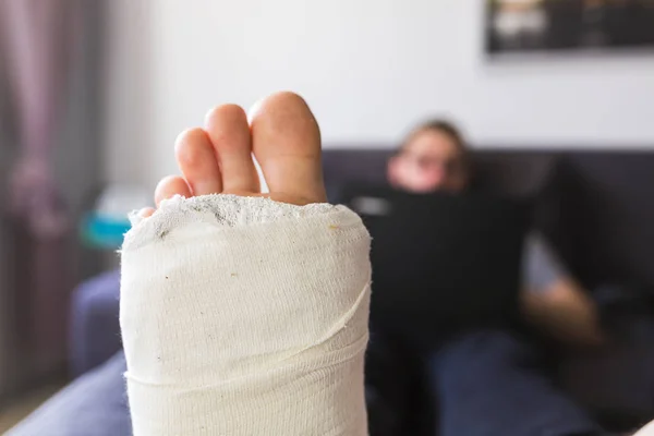 Close-up on a leg in a cast — Stock Photo, Image