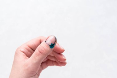 Silin ve yeşil antiseptik temiz. Zelenka lekeli adam.