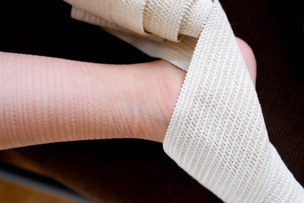 A pattern on the skin from a medical bandage. The elastic bandage squeezed the skin