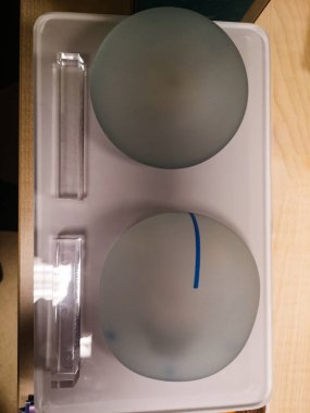 Resim göğüs implantlarının iki örneğini gösteriyor. Anatomik ve yuvarlak. Estetik ameliyat