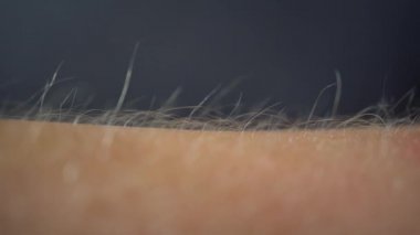 Kaz Vuruşları Alınıyor, Makro Görünüm