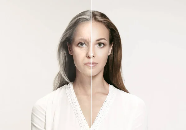 Perbandingan. Portrait of beautiful woman with problem and clean skin, aging and youth concept, beauty treatment — Stok Foto