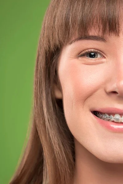 Hermosa mujer joven con abrazaderas de dientes — Foto de Stock