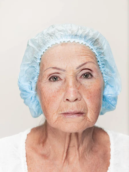 La cara de la mujer de mediana edad antes de la cirugía plástica —  Fotos de Stock