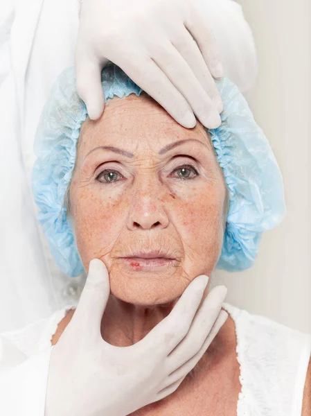 Cirujano haciendo control de la piel en la mujer de mediana edad antes de la cirugía plástica — Foto de Stock