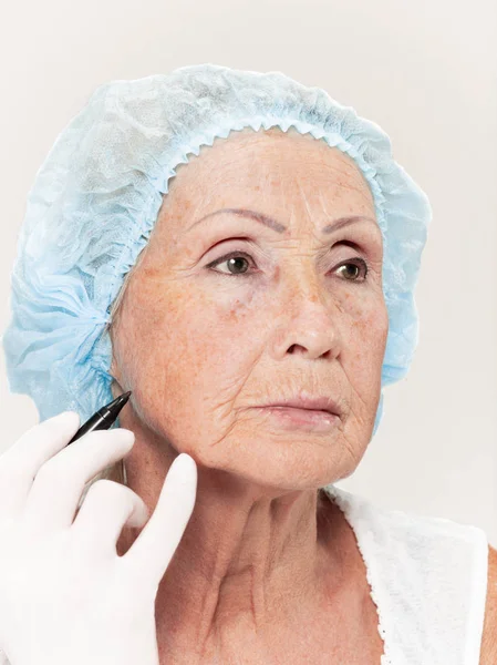 Ahli bedah melakukan pemeriksaan kulit pada usia pertengahan wanita sebelum operasi plastik — Stok Foto
