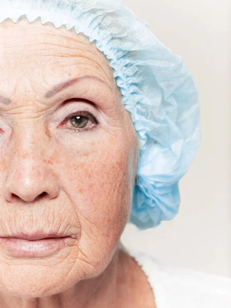 La cara de la mujer de mediana edad antes de la cirugía plástica —  Fotos de Stock