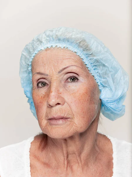 整形手术前中年妇女的面孔 — 图库照片