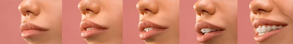 Красива молода жінка з зубними брекетами — стокове фото