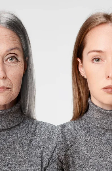 Comparación. Retrato de mujer hermosa con problema y piel limpia, envejecimiento y concepto de juventud, tratamiento de belleza —  Fotos de Stock