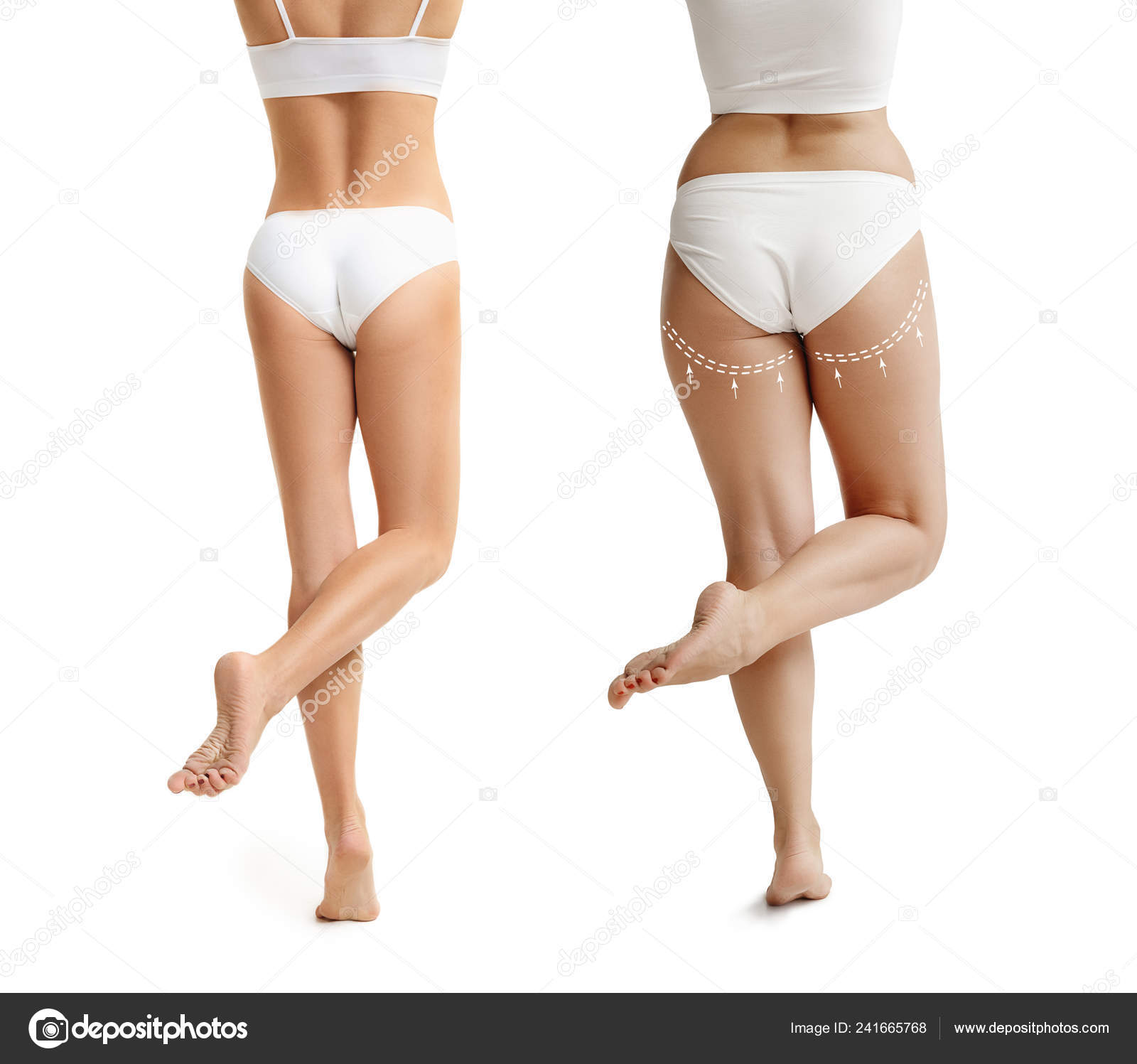 foto-molodie-tolstie