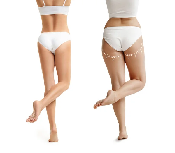 Dos mujeres jóvenes gruesas y delgadas tienen diferentes figuras —  Fotos de Stock