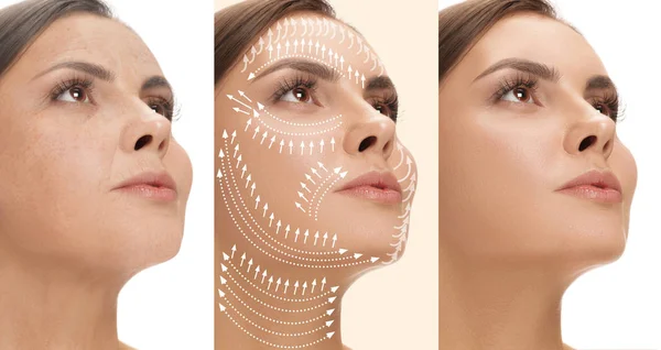 Beautiful female face, concept of skincare and lifting — Stock Photo, Image