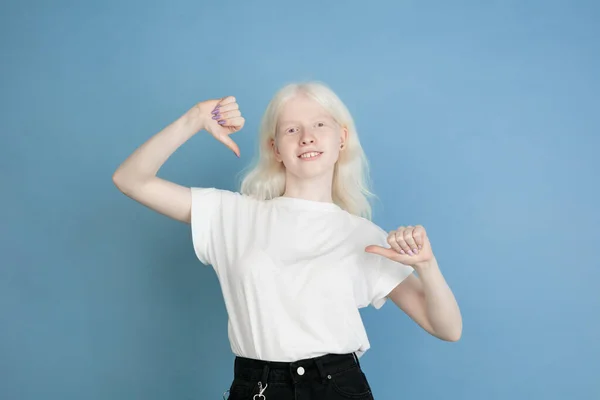 Porträt der schönen kaukasischen Albino-Mädchen isoliert auf blauem Studiohintergrund — Stockfoto