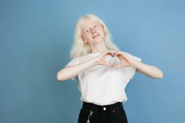 Portret van prachtige Kaukasische albino meisje geïsoleerd op blauwe studio achtergrond — Stockfoto