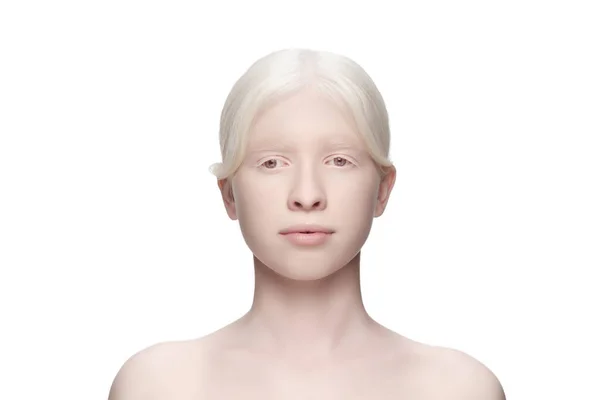 Ritratto di bella donna albina isolata su sfondo bianco da studio. Bellezza, moda, cura della pelle, concetto di cosmetici. — Foto Stock