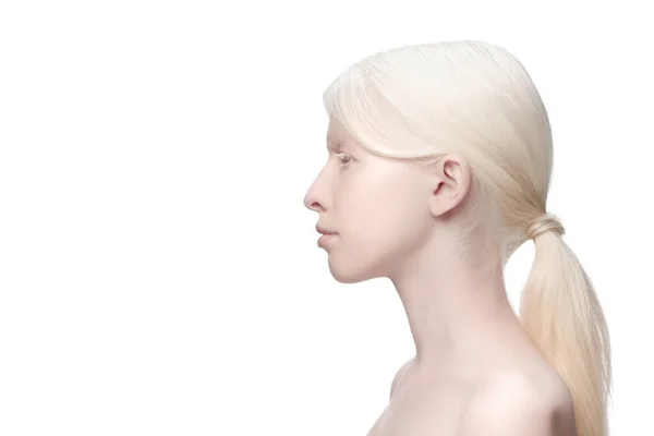 Porträtt av vacker albinokvinna isolerad på vit studio bakgrund. Skönhet, mode, hudvård, kosmetika koncept. — Stockfoto