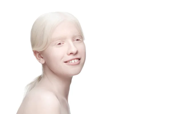 Portrait de belle femme albinos isolée sur fond de studio blanc. Beauté, mode, soins de la peau, concept cosmétique. — Photo