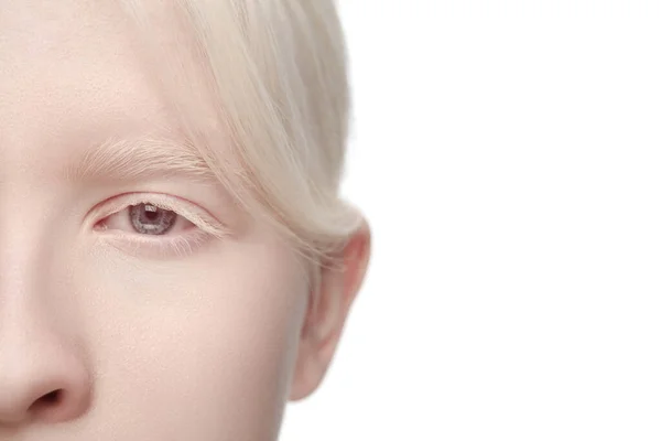 Portrait of beautiful albino woman isolated on white studio background. Beauty, fashion, skincare, cosmetics concept. — Stock Photo, Image