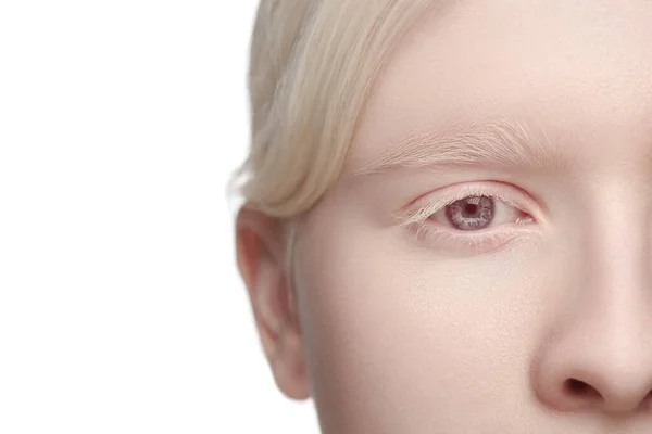 Retrato de bela mulher albina isolada no fundo do estúdio branco. Beleza, moda, cuidados com a pele, conceito de cosméticos. — Fotografia de Stock