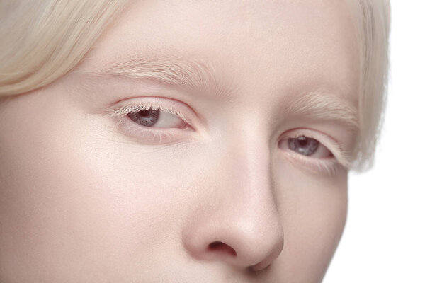 Портрет красивой альбиносы на белом фоне студии. Красота, мода, skincare, косметика.