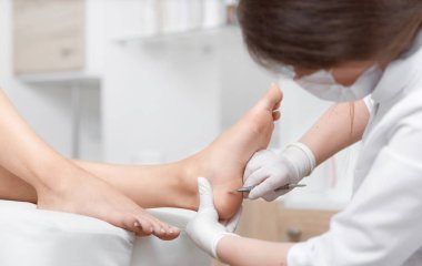 Profeesional Doktor Lehçe Kallus ve Mısır ayakları istemci üzerinde.