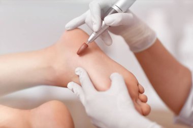Özel donanımları Bileme ve yordam yapmadan kullanarak ayak hastalıkları uzmanı