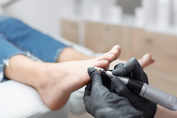 Primer Plano Del Médico Guantes Haciendo Procedimiento Para Pie Con —  Fotos de Stock