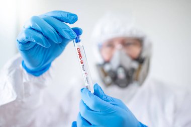 Biyolojik tehlike kimyevi koruyucu giysi (PPE) giyen tıp bilimadamı, hastane laboratuvarında COVID-19 deney tüpü tutan maske ve gözlükler. Erkek doktor ya da doktor Coronavirus vakasının sonucunu alıyor.