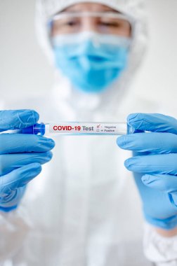 Kişisel koruyucu ekipman (PPE) giyen tıp bilimcisi, COVID-19 test tüpünü hastane laboratuvarında tutan maske ve eldivenler. Erkek doktor Coronavirus vakasının sonucunu alıyor. 2019-nCoV araştırması