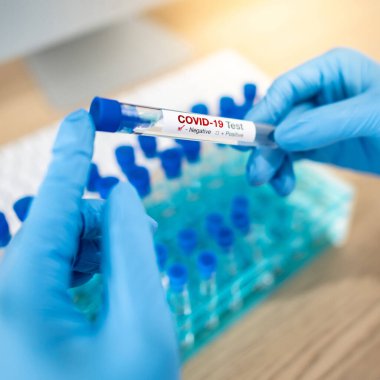 Hastane laboratuarında COVID-19 test tüpü tutan mavi steril lastik eldivenli tıp bilimci eli. Erkek doktor ya da doktor Coronavirus vakasının sonucunu alıyor. 2019-nCoV laboratuvar test konsepti