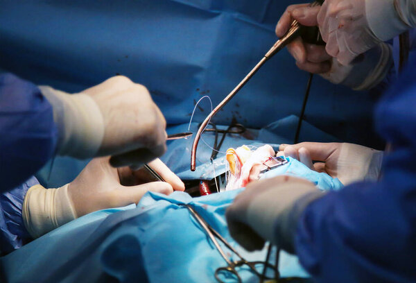 We work with the valve. Replacing the heart valve. Open heart surgery.