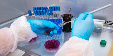 Laboratuvarda bakteri kültürü olan bir petri kabını tutan el.