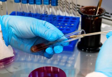 Laboratuvarda bakteri kültürü olan bir petri kabını tutan el.