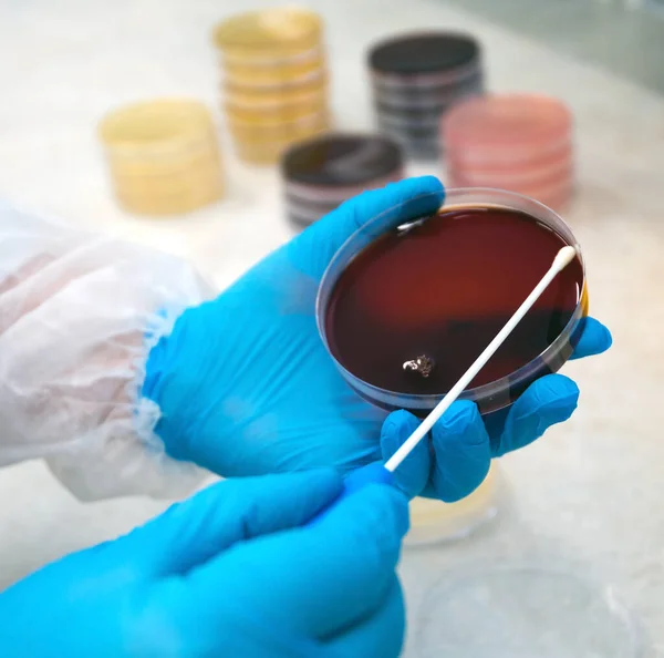 Hand holds a Petri dish with bacteria culture in the laboratory