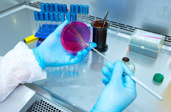 Hand holds a Petri dish with bacteria culture in the laboratory