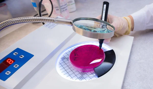 Hand Hält Eine Petrischale Mit Bakterienkultur Labor — Stockfoto