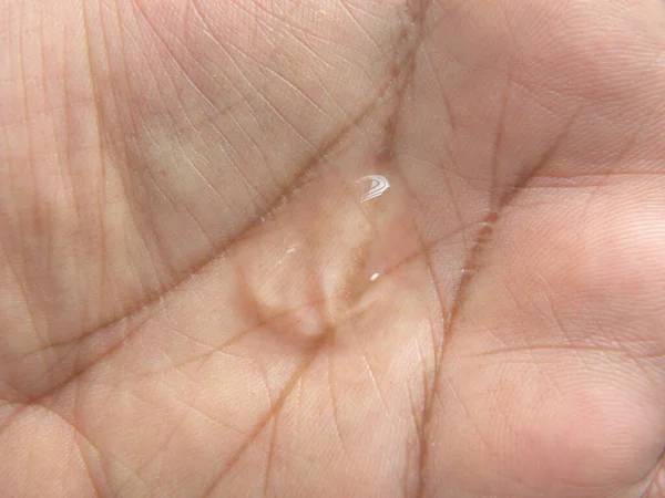Transparent dollop of Hand sanitizer liquid on palm of hand