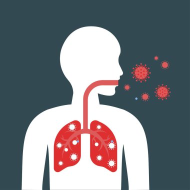 Wuhan coronavirus 19 ilgili, insan karakteri, akciğer enfeksiyonu ya da iltica eden virüs akciğerleri ve bakterileri için zararlı.