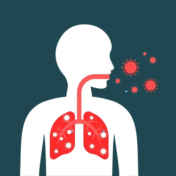 Wuhan coronavirus 19 ilgili, insan karakteri, akciğer enfeksiyonu ya da iltica eden virüs akciğerleri ve bakterileri için zararlı.