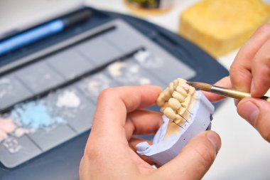 Teknisyen dişçi alt ve üst metal seramik protez dişleriyle çalışıyor. Diş teknisyeni çene modeliyle fırçayla çalışır