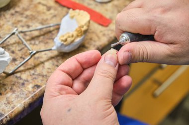 Erkek diş teknisyeni bir 3d çalışma diş için yazdırılan kalıp laboratuarda implantları.