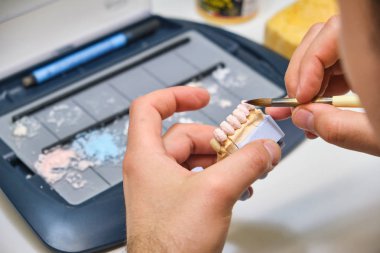 Teknisyen dişçi alt ve üst metal seramik protez dişleriyle çalışıyor. Diş teknisyeni çene modeliyle fırçayla çalışır